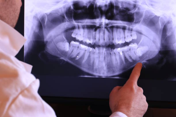 Best Root Canal Emergency Dentist  in Shinnston, WV
